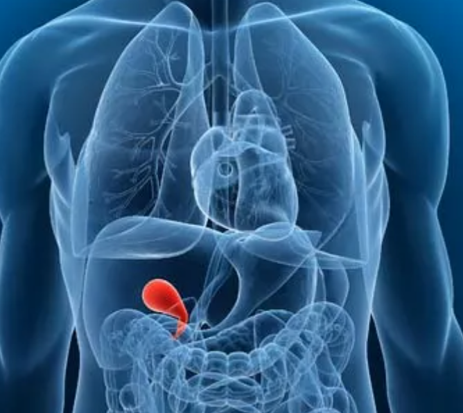 How to Save Your Gallbladder from an Early Demise...